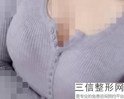 上海半长久乳晕漂红整形大概需要费用(2022年09月半长久乳晕漂红均价为：4404元)