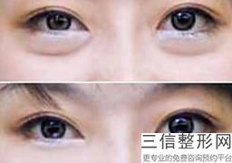 上海半长久眼线美容一共多少钱(2022年09月半长久眼线均价为：4462元)