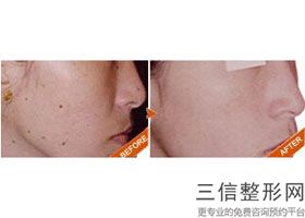 上海包皮过长治疗整容正常价位(2022年09月包皮过长治疗均价为：4387元)