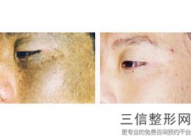 上海包皮过短矫正整形好多钱(2022年09月包皮过短矫正均价为：4310元)