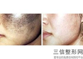 上海包皮环修复包皮美容需花费多少(2022年09月包皮环修复包皮均价为：4649元)