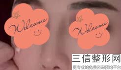 上海鼻背纹美容价格一览表(2022年09月鼻背纹均价为：4548元)