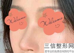 上海鼻部多项整容在价格是多少(2022年09月鼻部多项均价为：4497元)