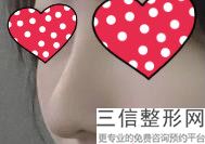 上海鼻部硅胶假体取出美容大约价格(2022年09月鼻部硅胶假体取出均价为：4541元)