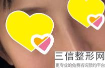 上海鼻部矫正美容要花多少价钱(2022年09月鼻部矫正均价为：4488元)