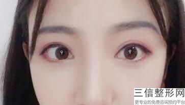 上海传统纹眼线整形的价格是怎么样的(2022年09月传统纹眼线均价为：4396元)