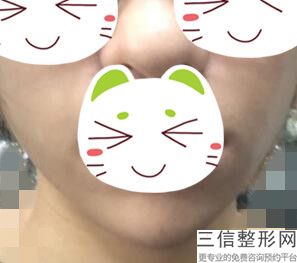 上海唇部变薄美容价格方式(2022年09月唇部变薄均价为：4500元)