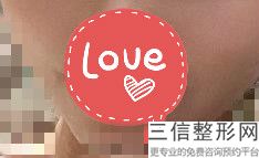 上海唇部激光整形大致收费标准(2022年09月唇部激光均价为：4414元)