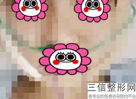 上海唇部矫正整形的价格要多少钱呢(2022年09月唇部矫正均价为：4565元)