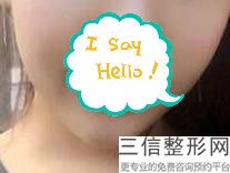 上海唇部脱毛整容正常费用范围(2022年09月唇部脱毛均价为:4653元)