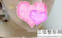 上海唇部微笑整容价格是多少呢(2022年09月唇部微笑均价为:4536元)