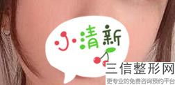 上海唇部微笑整容一般是好多钱(2022年09月唇部微笑均价为：4291元)
