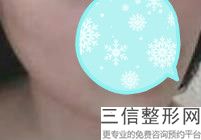 上海唇裂整形整形的价格贵吗(2022年09月唇裂整形均价为：4303元)