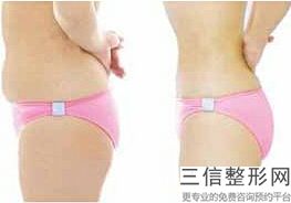 上海打针丰胸整容价格一览表(2022年09月打针丰胸均价为：4455元)