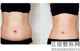 上海电动负压瘦小腿美容价格具体多少(2022年09月电动负压瘦小腿均价为:4417元)