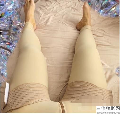 上海电子吸脂瘦小腿美容价位是多少(2022年09月电子吸脂瘦小腿均价为：4646元)