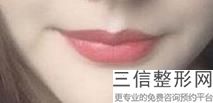 上海嘟嘟唇丰唇美容一般价格参考(2022年09月嘟嘟唇丰唇均价为：4406元)