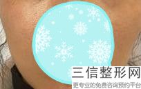上海嘟嘟唇纹唇美容现在市场价格(2022年09月嘟嘟唇纹唇均价为：4471元)