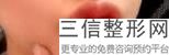 上海嘟嘟唇纹唇整容价格一般是多少(2022年09月嘟嘟唇纹唇均价为：4505元)