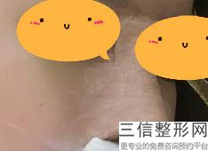 上海短鼻整形整容大约费用(2022年09月短鼻整形均价为：4376元)