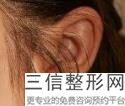 上海耳廓再造术耳朵美容多少钱才够呢(2022年09月耳廓再造术耳朵均价为：4712元)