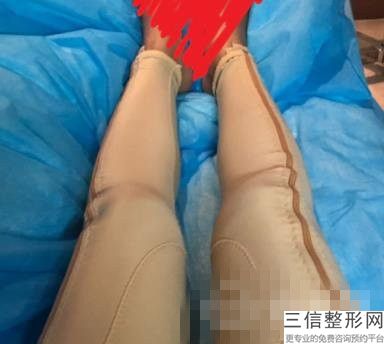 产后妈妈如何丰胸，产后如何丰胸