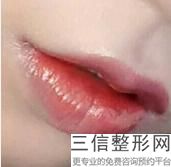 东莞那个纹唇医院好，纹唇效果怎么样