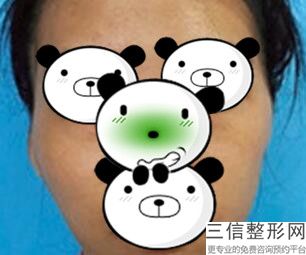 丰上唇的方法有哪些，丰唇有几种方法