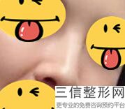 杭州华山冷院长做鼻子好吗，华山刘军做的鼻子怎么样