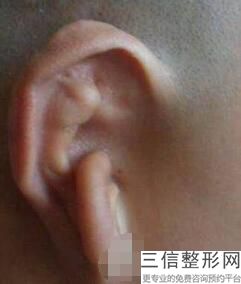 合肥哪家耳科好，合肥治疗耳科良好的医院