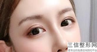 合肥做眼睛激光良好的医院，合肥哪家医院激光祛斑效果好