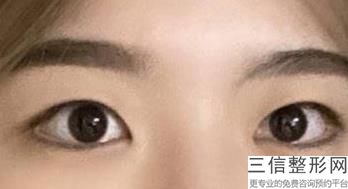 经期不能纹眼线吗，大姨妈期间能纹眼线吗