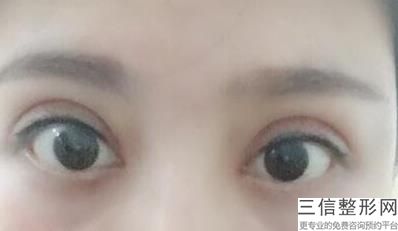 经期不能纹眼线吗，大姨妈期间能纹眼线吗