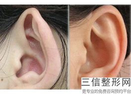 看耳朵那家医院好，呼和浩特耳鸣哪个医院好