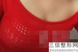 隆乳术后护理，隆胸术后护理注意事项