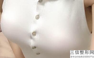 美莱整形医院隆胸，假体隆胸整容医院