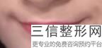 沈阳丰唇哪家好，沈阳哪家纹眉纹的好