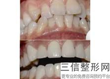 吴江牙科诊所，吴江哪里看牙科比较好