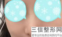 重庆哪里隆鼻效果好，重庆隆鼻哪家医院良好