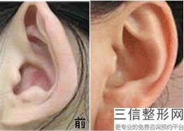 良好的耳朵整形医院，耳朵整形医院哪里好