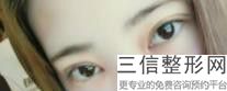 做过双眼皮手术后注意事项，双眼皮术后注意事项有哪些-为什么-
