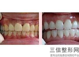 安顺牙齿矫正哪里好，安顺比较好的牙科医院哪家好