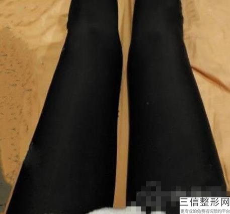 包头抽脂手术多少钱啊，腰腹加大腿吸脂多少钱