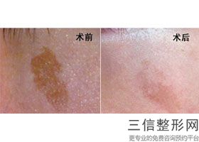 包头哪家医院做包皮手术好，包头哪个医院有美容科