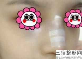 北京鼻综合哪个医生好，北京鼻综合十大专家