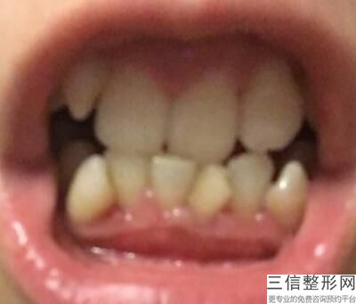 北京禾禾齿科张栋梁，北京禾禾口腔医院