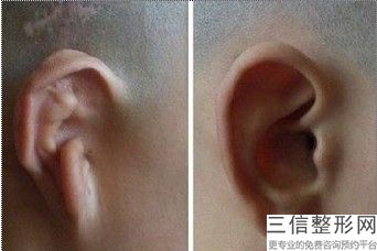 北京丽都耳部整形医院怎么样，北京耳再造哪家医院好