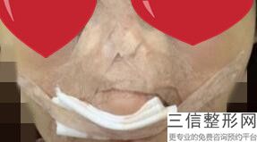 北京联合丽格谁做鼻子好，联合丽格做双眼皮怎么样