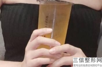 北京圣嘉新隆胸案例，圣嘉新整容报价