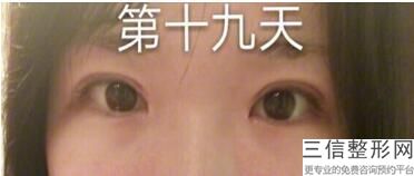 北京双眼皮修复好但不知名的医生，北京修复双眼皮的专家都有哪些